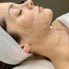 Load image into Gallery viewer, (NEW) Botox Facial